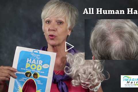 Thinning White Hair