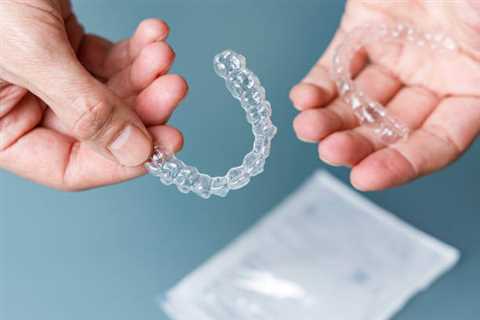 How Does Invisalign Work? Answers to Patients’ Most Frequently Asked Questions About Invisalign -