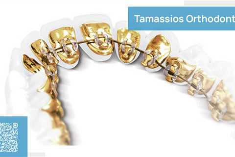 Standard post published to Tamassios Orthodontics - Orthodontist Nicosia, Cyprus at March 27, 2023..