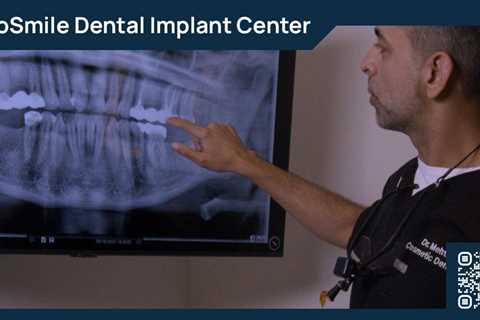 Standard post published to ProSmile Dental Implant Center at April 10, 2023 16:02