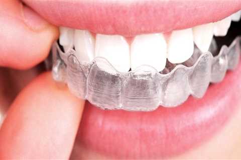 Can I Use Whitening Toothpaste with Invisalign Clear Braces?