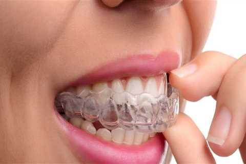 Can I Eat and Drink with Invisalign Clear Braces?