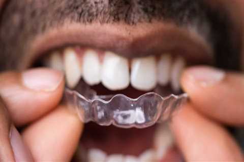 How Often Should You Visit the Dentist After Getting Invisalign Clear Braces?