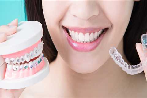 Affordable Alternatives to Invisalign Clear Braces