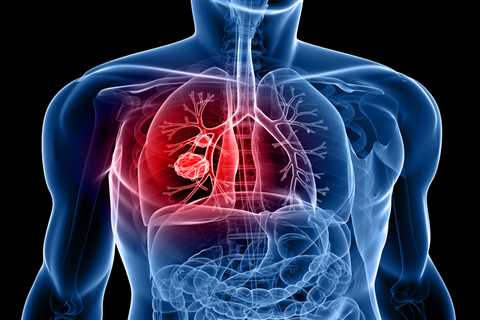 The symptom of deadly lung cancer that strikes as soon as you wake up – and 9 other signs