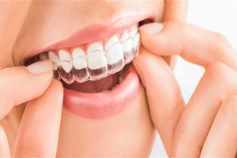 How to Get the Most Out of Your Invisalign Appointment