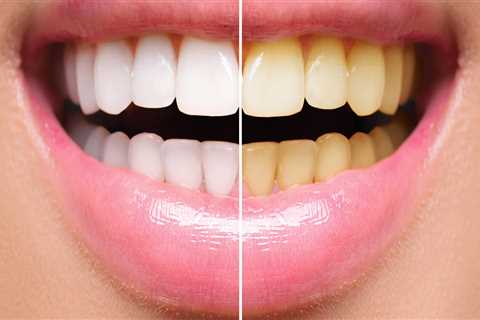 What is cosmetic dentistry treatment?