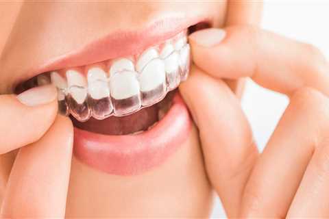 Do All Dentists Offer Invisalign Treatment?