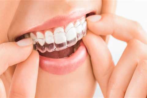 Get The Smile You Deserve With Invisalign Treatment From Your Trusted Monroe Dentist