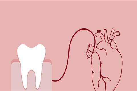Can Poor Oral Health Contribute to Systemic Diseases?