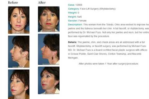 Lakeshore Facial Plastic Surgery