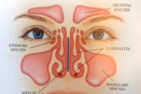 Septoplasty Seattle | Deviated Septum Surgery