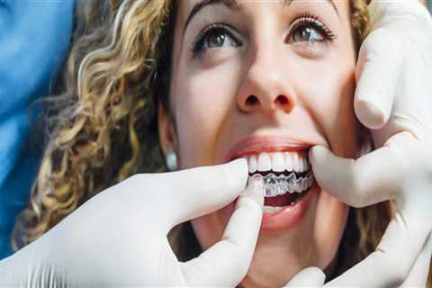 Get A Perfect Smile With Invisalign Treatment From A Skilled Dentist In Spring, TX