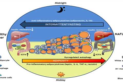 How to Prevent Intermittent Fasting and Fasting-Related Headaches