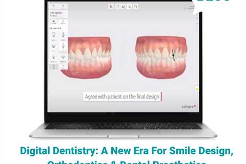 Standard post published to Smalto Dental Clinic at June 05, 2023 10:00