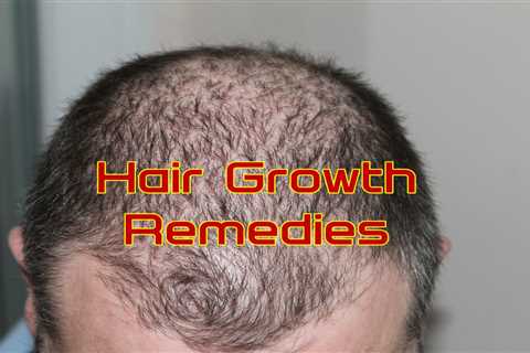 10 Home Remedies for Hair Growth - Home Remedies App