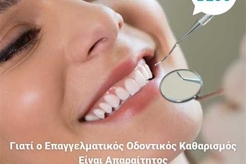 Standard post published to Smalto Dental Clinic at June 12, 2023 10:00