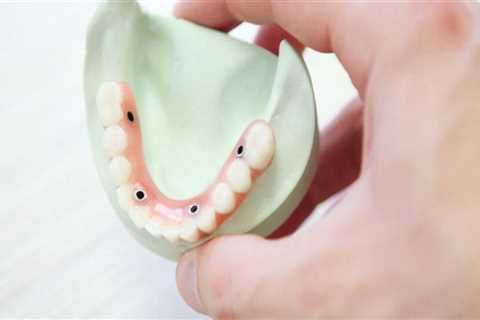 The Benefits of Dentures: Restoring Confidence and Functionality