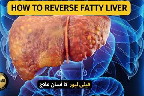 How to Reverse Fatty Liver | Fatty Liver Treatment | Fatty Liver Remedy | Liver Detox | Urdu / Hindi