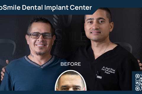 Standard post published to ProSmile Dental Implant Center at June 23, 2023 16:00