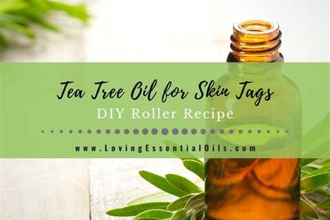 Tea Tree Oil for Skin Tags with DIY Roller Blend Recipe