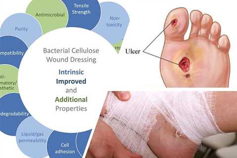 Wound Healing and Intermittent Fasting