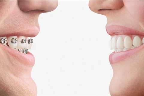 5 Interesting Facts About Orthodontics