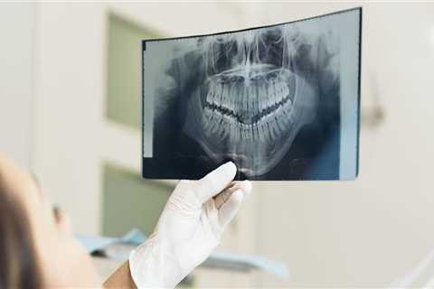 How To Determine If You Need A Dental X-ray Before Visiting A Dentist In New Jersey