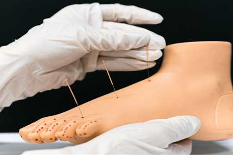 Free Acupuncture Training