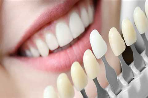 What are the best teeth restoration?