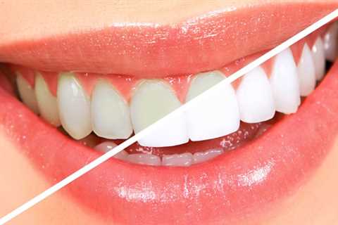 Standard post published to Symeou Dental Center at August 04, 2023 10:00