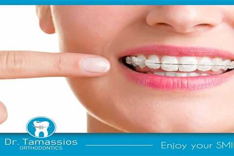 Standard post published to Tamassios Orthodontics - Orthodontist Nicosia, Cyprus at August 09, 2023 ..