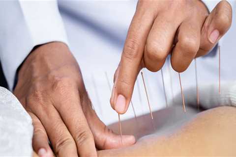 What Conditions Can Be Treated with Acupuncture?