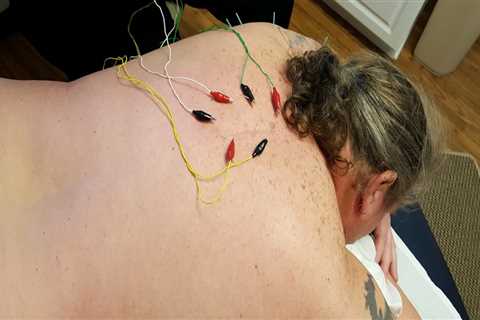 What Does Acupuncture Really Do?