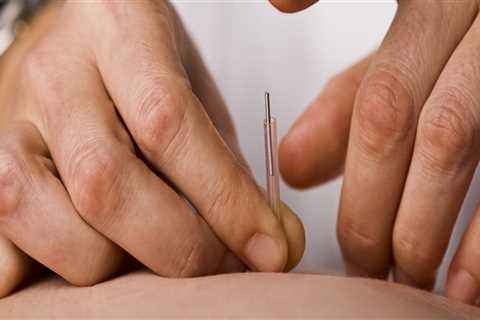 Can Children Receive Acupuncture Treatments?