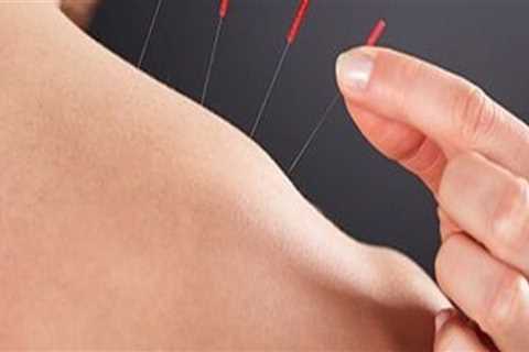 Can I Receive Acupuncture with a Pacemaker or Other Implanted Device?