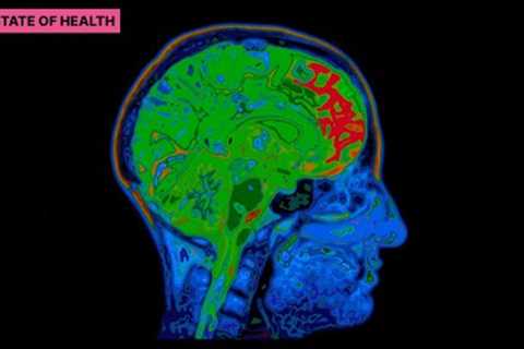 Alzheimer''s MIND Diet: Can Your Food Choices Outsmart Cognitive Decline?