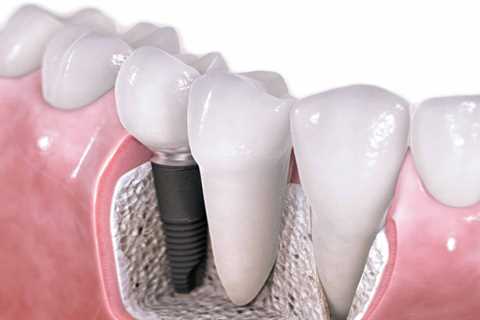 Standard post published to Symeou Dental Center at September 03, 2023 10:00