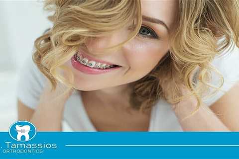 Standard post published to Tamassios Orthodontics - Orthodontist Nicosia, Cyprus at September 06,..