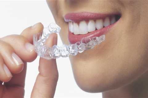 What to Know After Your Child's Invisalign Appointment