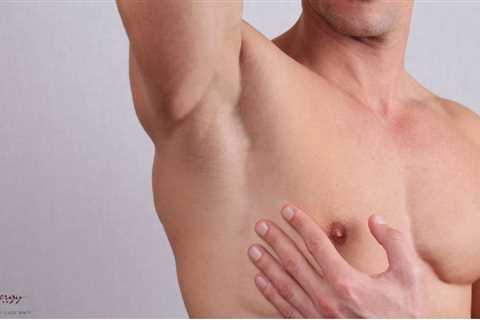 Preparing for Male Breast Reduction: A Comprehensive Guide