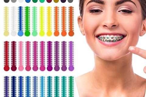 Standard post published to Tamassios Orthodontics - Orthodontist Nicosia, Cyprus at October 03,..