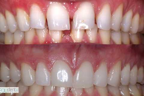 Standard post published to Symeou Dental Center at October 05, 2023 09:00