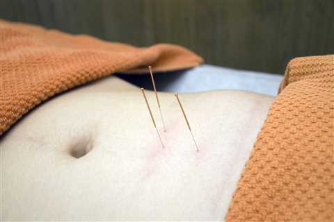 THE BENEFITS OF ACUPUNCTURE FOR DIGESTIVE DISORDERS