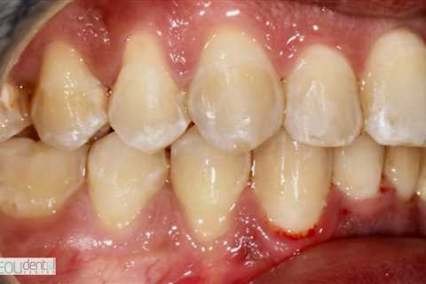 Standard post published to Symeou Dental Center at October 07, 2023 09:00