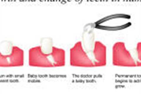 Tooth development