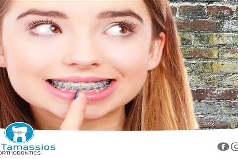 Standard post published to Tamassios Orthodontics - Orthodontist Nicosia, Cyprus at October 25,..