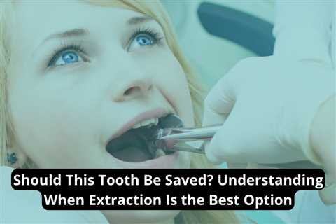 Should This Tooth Be Saved? Understanding When Extraction Is the Best Option