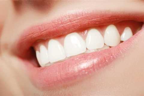 Discover the Best Toothpaste for Gums Recession: A Comprehensive Guide - Receding Gums Treatment..