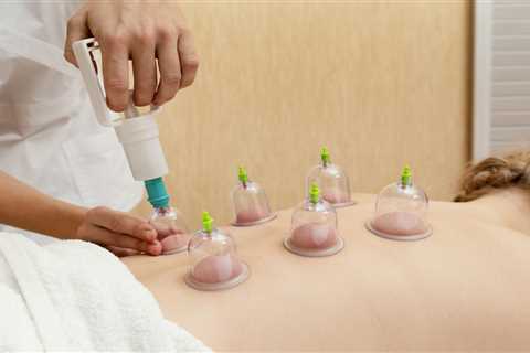 HOW TO USE CUPPING THERAPY FOR PAIN RELIEF